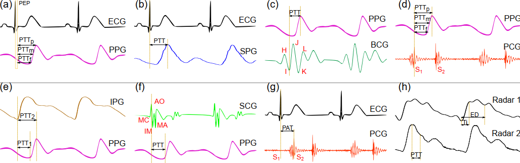 Non-invasive continuous blood pressure monitoring